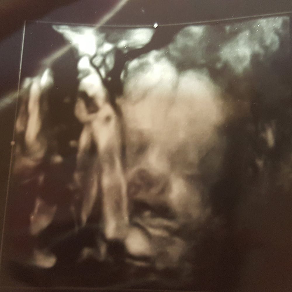 Meet your Posher, Aurelia